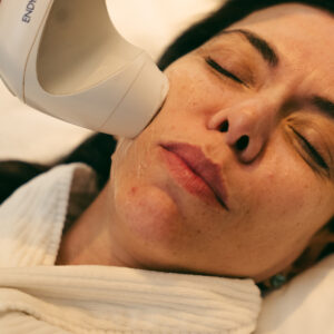 Endymed (Radiofrequência Facial) - Para Áreas Pequenas