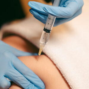 Intradermoterapia (Enzimas)