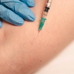 PEIM (Procedimento Estético Injetável para Microvasos)